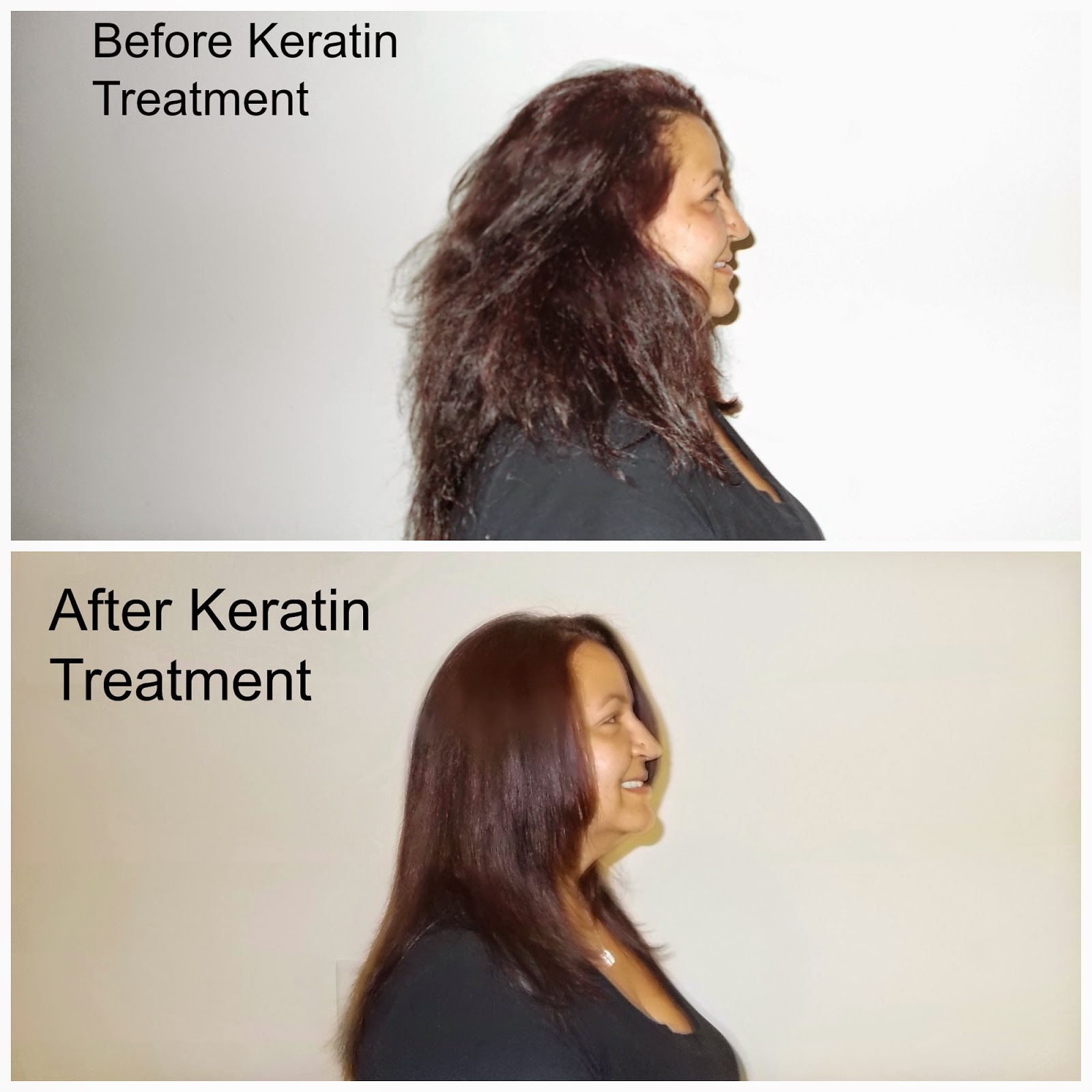 Hair Replacement Orlando Orlando Botox Treatment Vs Keratin Treatment