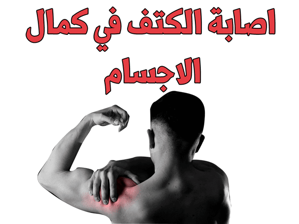 اصابة الكتف في كمال الاجسام