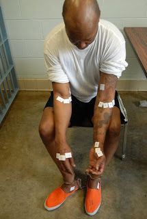 Romell Broom, photographed shortly after he survived a botched execution attempt in 2009.