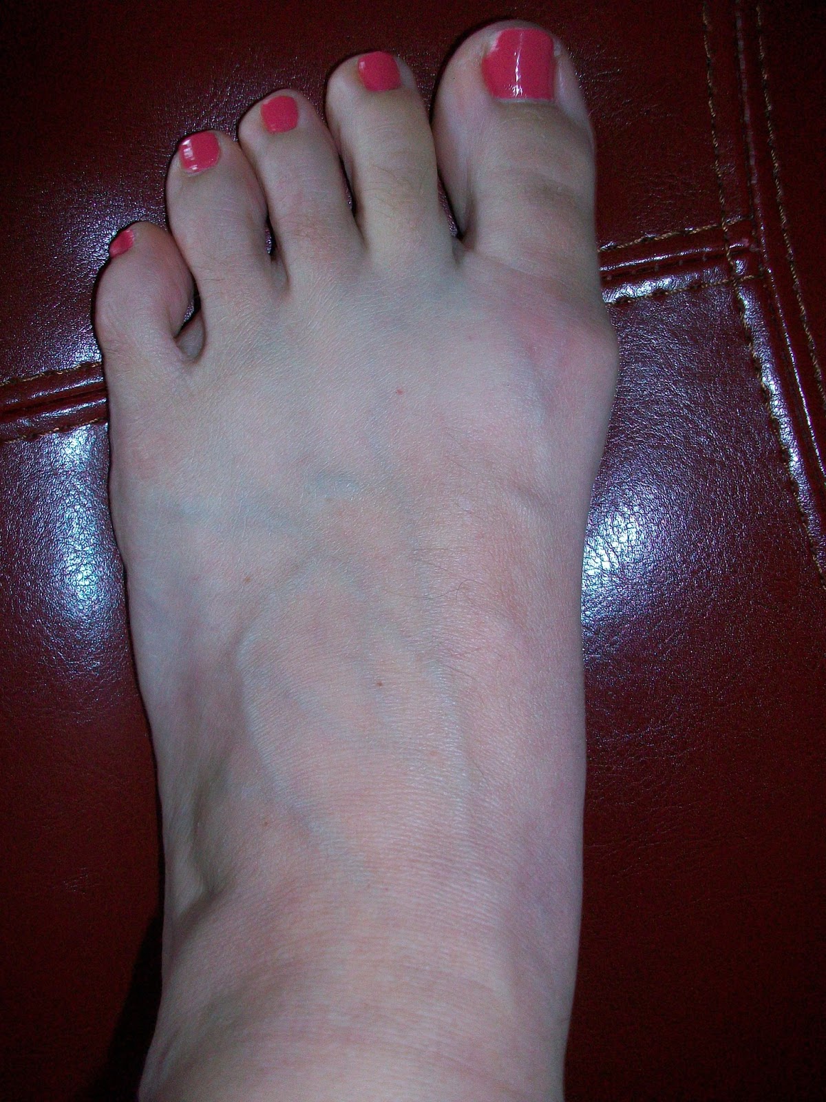 Post Surgery Ankle Fusion Boot Post Surgery Ankle Fusion Boot
