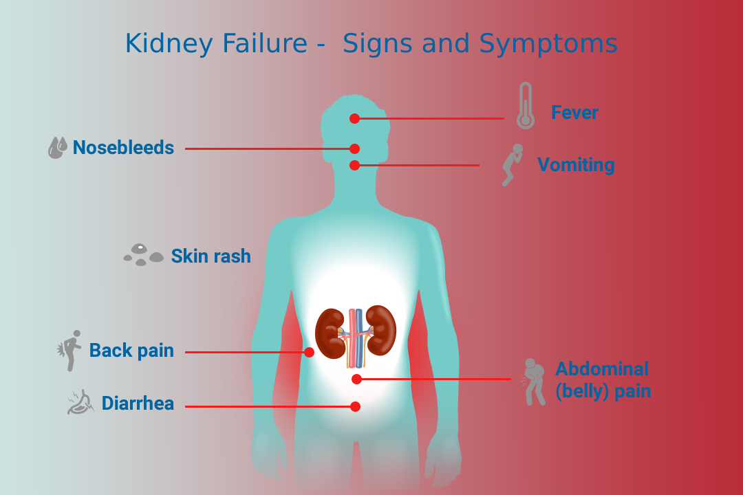 signs-and-symptoms-of-kidney-failure-ayurvedic-kidney-failure-treatment