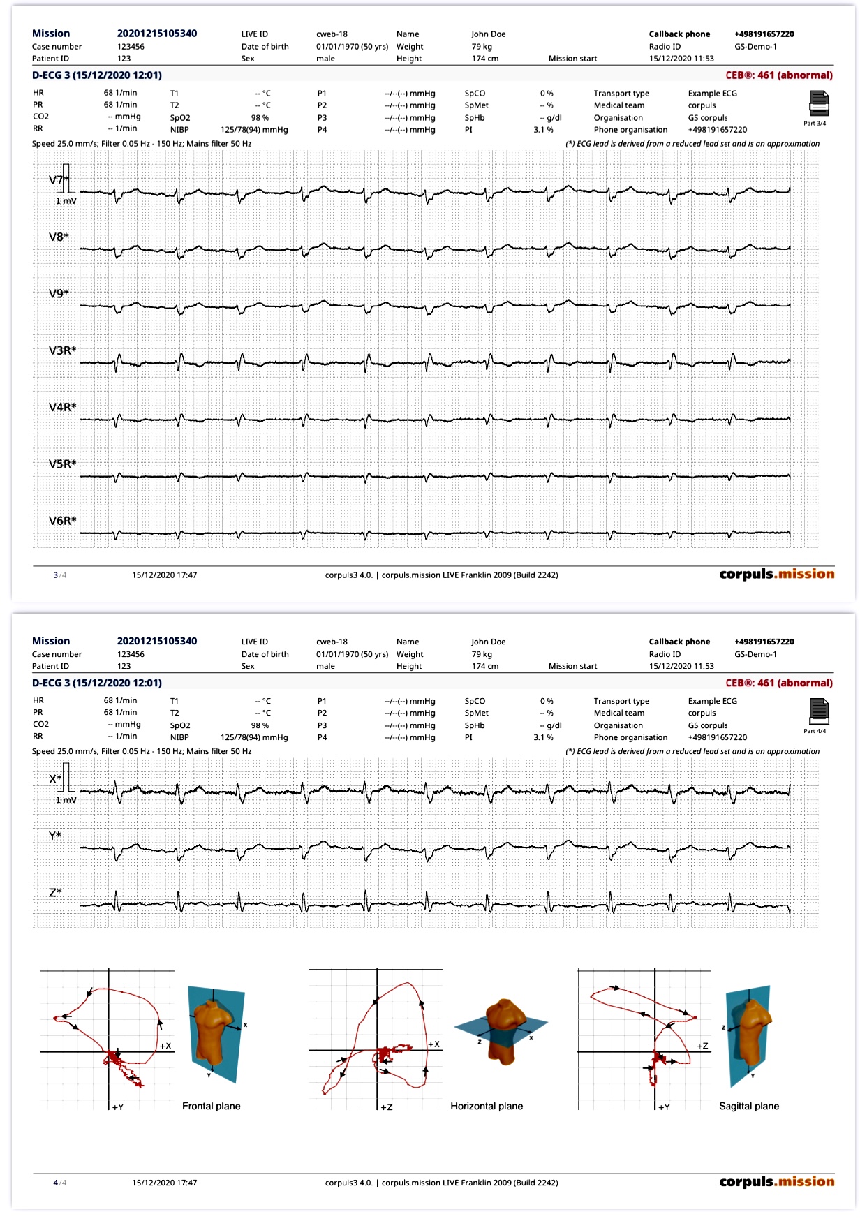ECG Educator Blog : 08/15/21