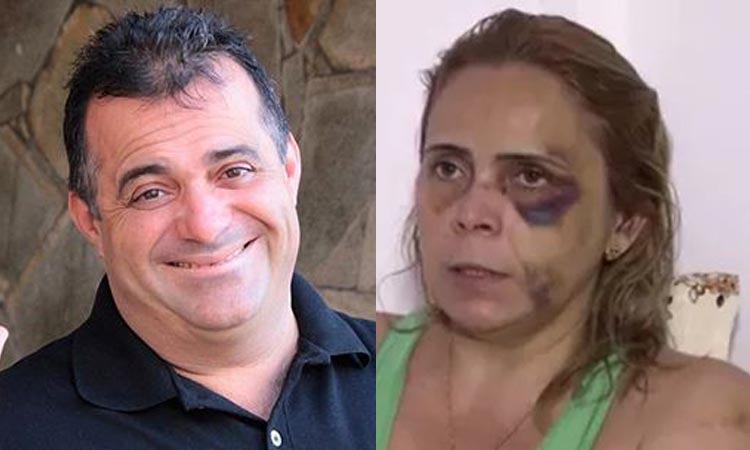 Renato Fechine agrediu a ex-namorada, apontam laudos