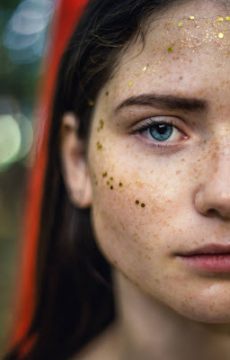 Prevention of freckles and melasma