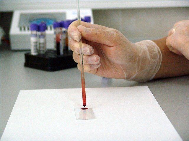 Blood Tests Meaning for Chronic Kidney Disease Blood Tests Meaning for Chronic Kidney Disease