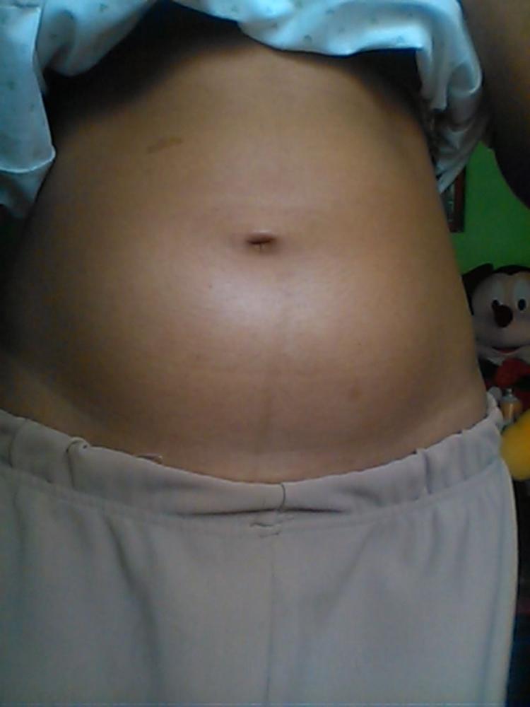 Tanda hamil 1 bulan