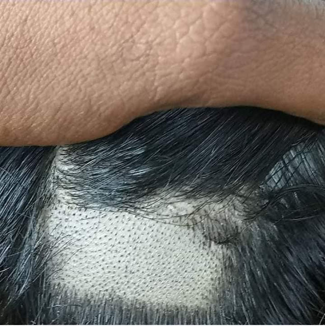 Home made head shaving for removing Dandruff Closeup Images Village Barber Stories