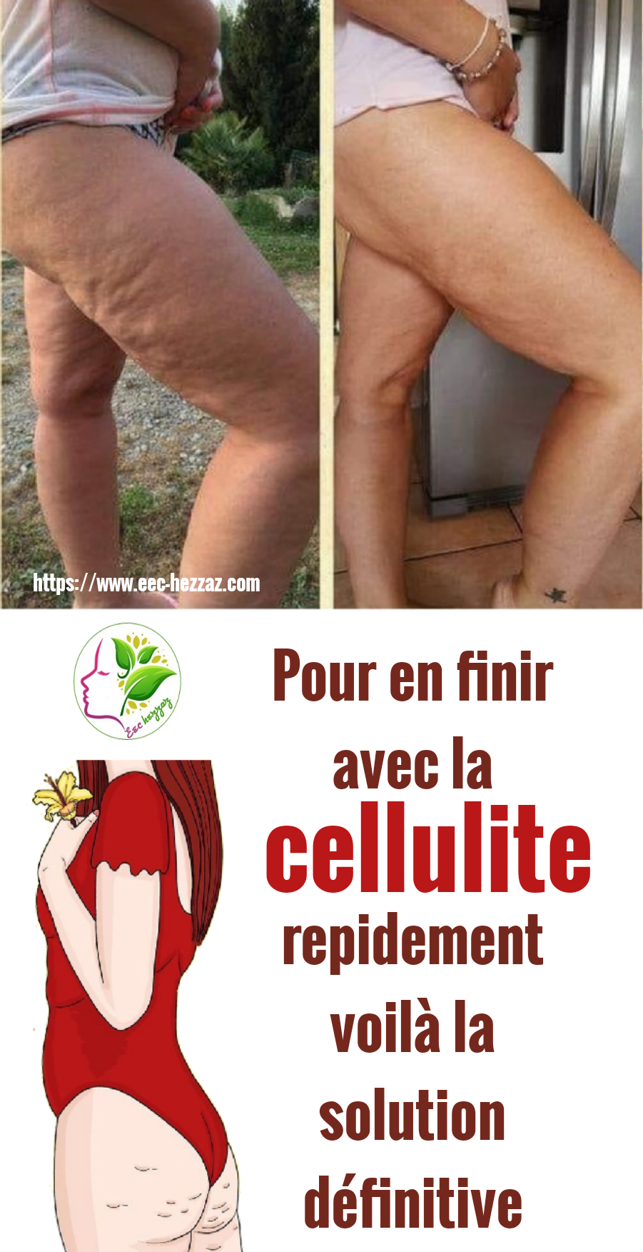 Pour en finir avec la cellulite repidement voilà la solution définitive