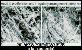 Imagen diferencia de fibras colágeno en escayola