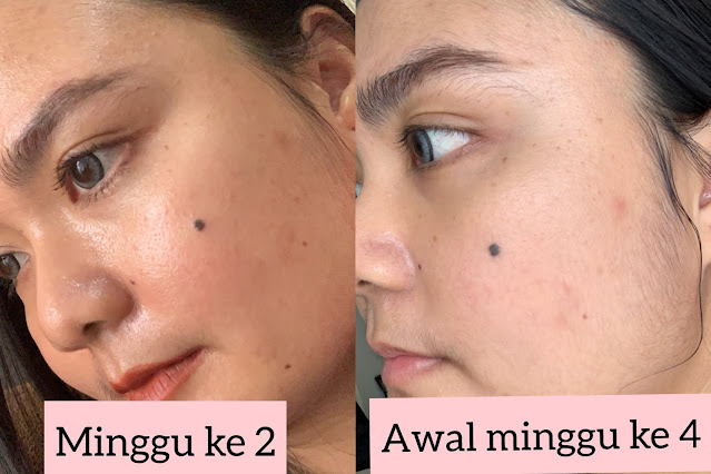 DATGLOWSKIN SERUM BRIGHTENING REVIEW DATGLOWSKIN SERUM BRIGHTENING REVIEW
