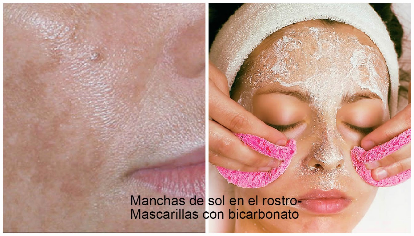 Mascarilla de bicarbonato para quitar las manchas de sol ~ cositasconmesh
