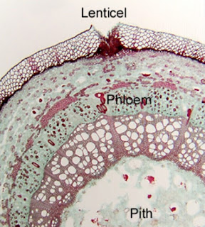 Lentisel di bawah mikroskop