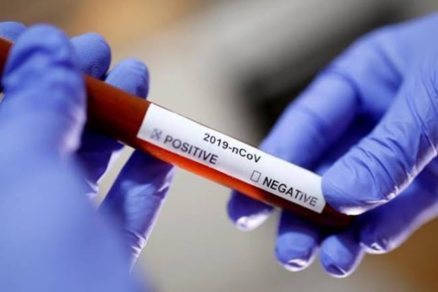 المهدية : تسجيل 23 إصابة جديدة بفيروس كورونا