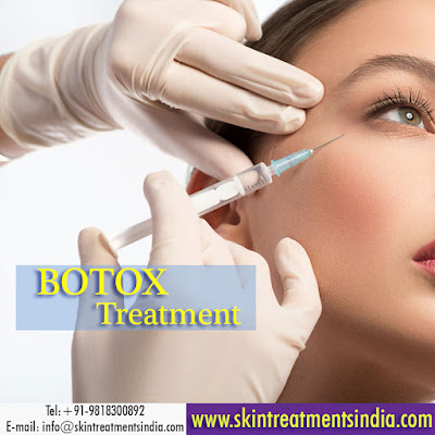 #botox #skintreatment