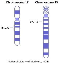 BRCA genetic mutation/Shromosome 17 and Chromosome 13 - infographic from National Library of Medicine