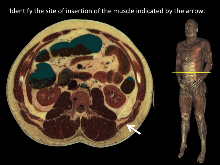 Anatomical Basis of Clinical Practice Practice Questions [Sectional