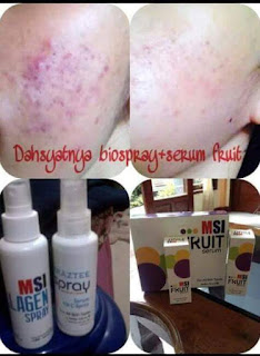testimoni-bio-spray-msi