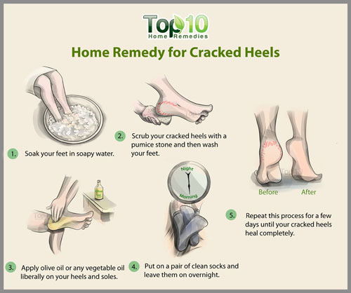 Beauty And Fashion Tips For You 10 Home Remedies Tips For Cracked