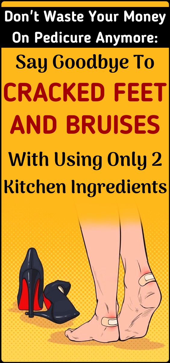 This is how to treat cracked feet at home Healthy Lifestyle