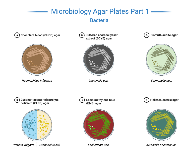 MICROBIOLOGY BLOG FOR STUDENTS (MBLOGSTU) Procedure for preparation of Culture Media