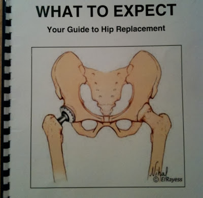 Medical illustration focused on hip replacement device