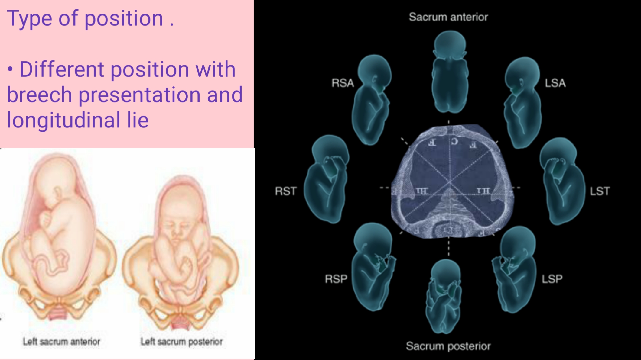 variable presentation fetus