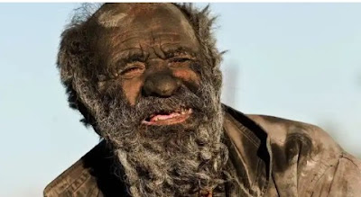 See The World’s Dirtiest Man Who Hasn't Bathed In 66 Years, His Skin Looks Like Concrete