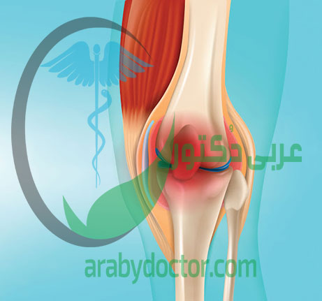 التهاب المفاصل :الاعراض والاسباب وطرق العلاج التهاب المفاصل :الاعراض والاسباب وطرق العلاج