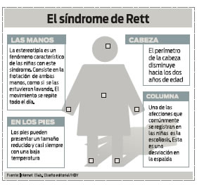 Orientar: Que es el Síndrome de Rett