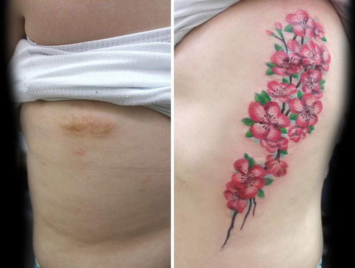 Tattoo Artist Offers Free Work For Survivors Of Domestic Violence - This tattoo covers up a scar left by a bullet: