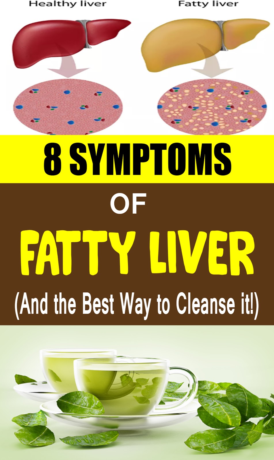 8 Common Symptoms of Fatty Liver (And the Best Way to Cleanse it!)