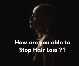 Its time to know all your options for treating hair loss -- Act Immediately !!
