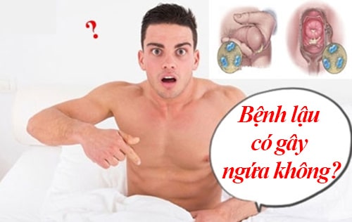 bệnh lậu có gây ngứa không