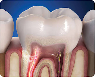 Dents douloureuses: causes, remèdes