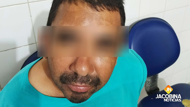 Guarda Municipal prende homem após a própria mãe acusá-lo de agressão em Jacobina