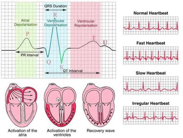 PHARMACO PLUS ERRATIC HEART BEAT ARRHYTHMIA understanding-and-managing-arrhythmias-the-health-guidance