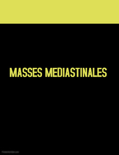 MASSES MEDIASTINALES