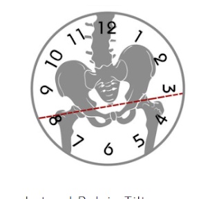 Screen shot from Pelvic Clock Instructor Course Shows  the bottom of a misaligned spine on top of an analog clock face link opens in a new tab