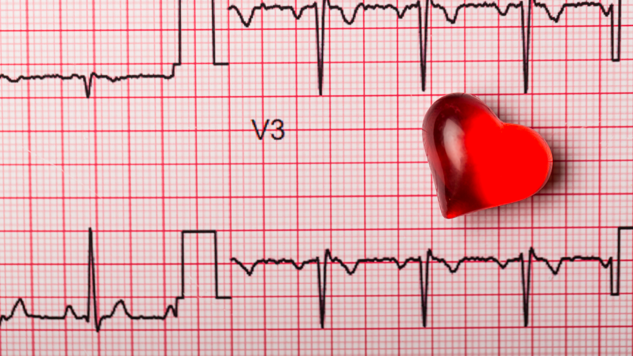 Simple Guidance For You In Home Healthcare [Can An Ekg Detect A Heart