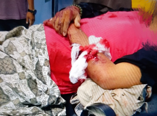 Oknum Geuchik di Aceh Utara, Bacok Warganya dengan Parang Agustus 29, 2020