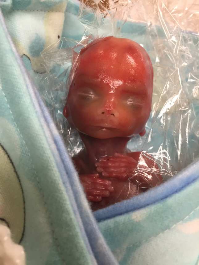 Como es un bebe a las 18 semanas de embarazo
