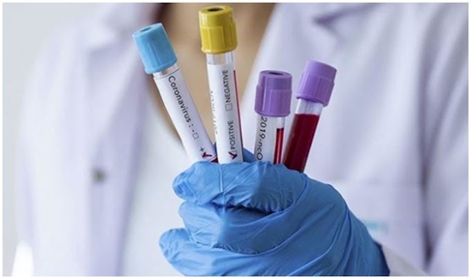 Türkiye'de Yapılan Koronavirüs Testleri Ne Durumda