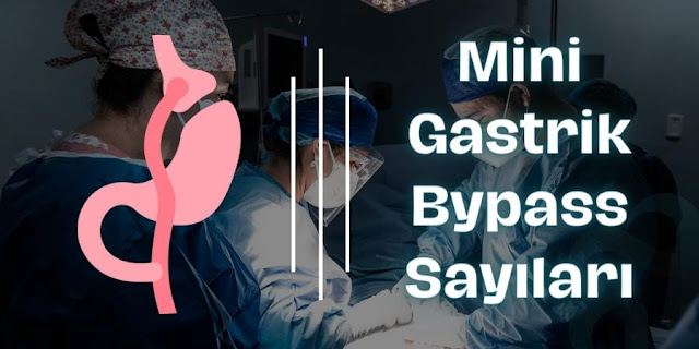 Mini Gastrik Bypass Sayıları