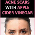 Home Remedies For Scars On Face