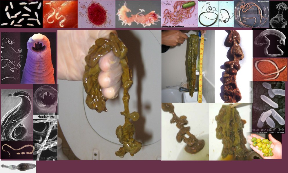 Why, What & How is a Colon Cleanse