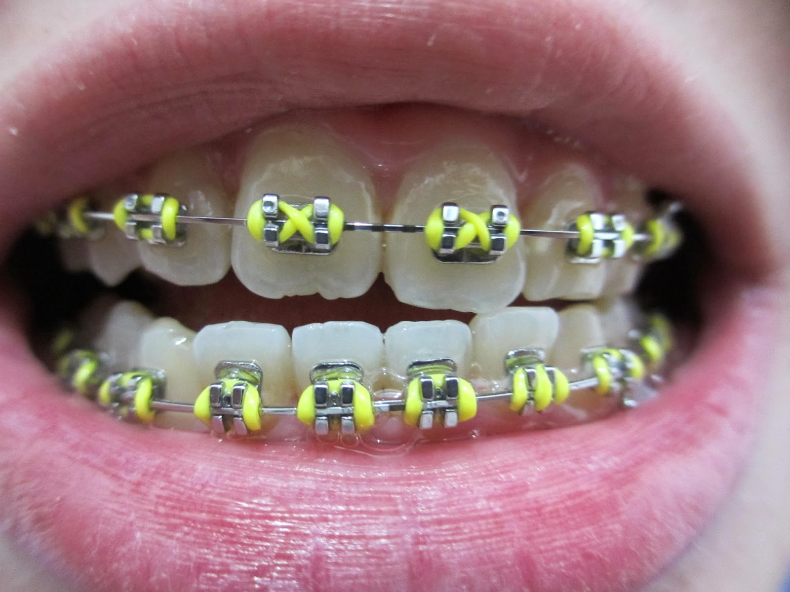 Dear you. Braces Appointment