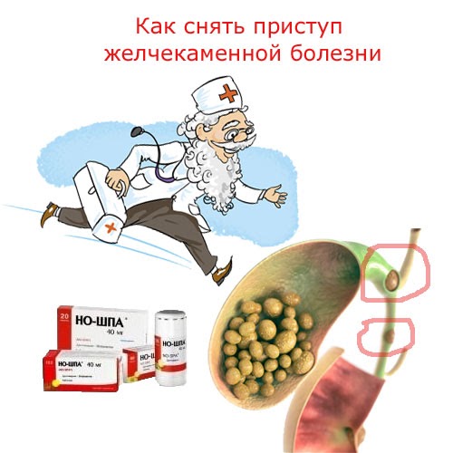 Как снять приступ печени в домашних условиях