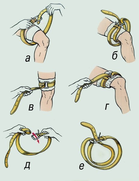 Как сделать жгут на шею. Смотреть фото Как сделать жгут на шею. Смотреть картинку Как сделать жгут на шею. Картинка про Как сделать жгут на шею. Фото Как сделать жгут на шею Как сделать жгут на шею. Смотреть фото Как сделать жгут на шею. Смотреть картинку Как сделать жгут на шею. Картинка про Как сделать жгут на шею. Фото Как сделать жгут на шею