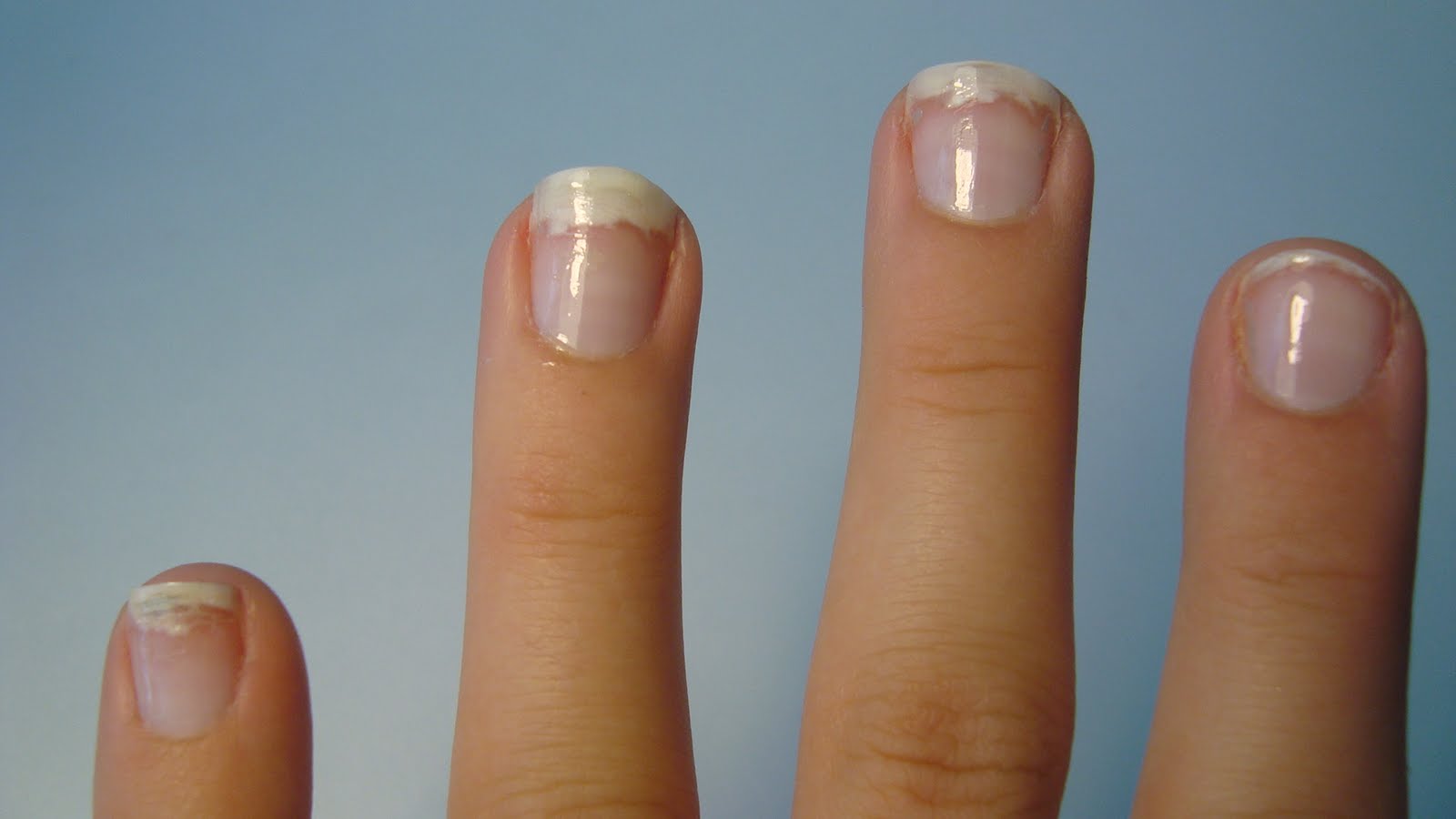 Hard as wrap di sally hansen dove 