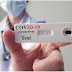 Κατηγορηματικά αντίθετος ο ΠΦΣ στη διενέργεια των self tests στα φαρμακεία